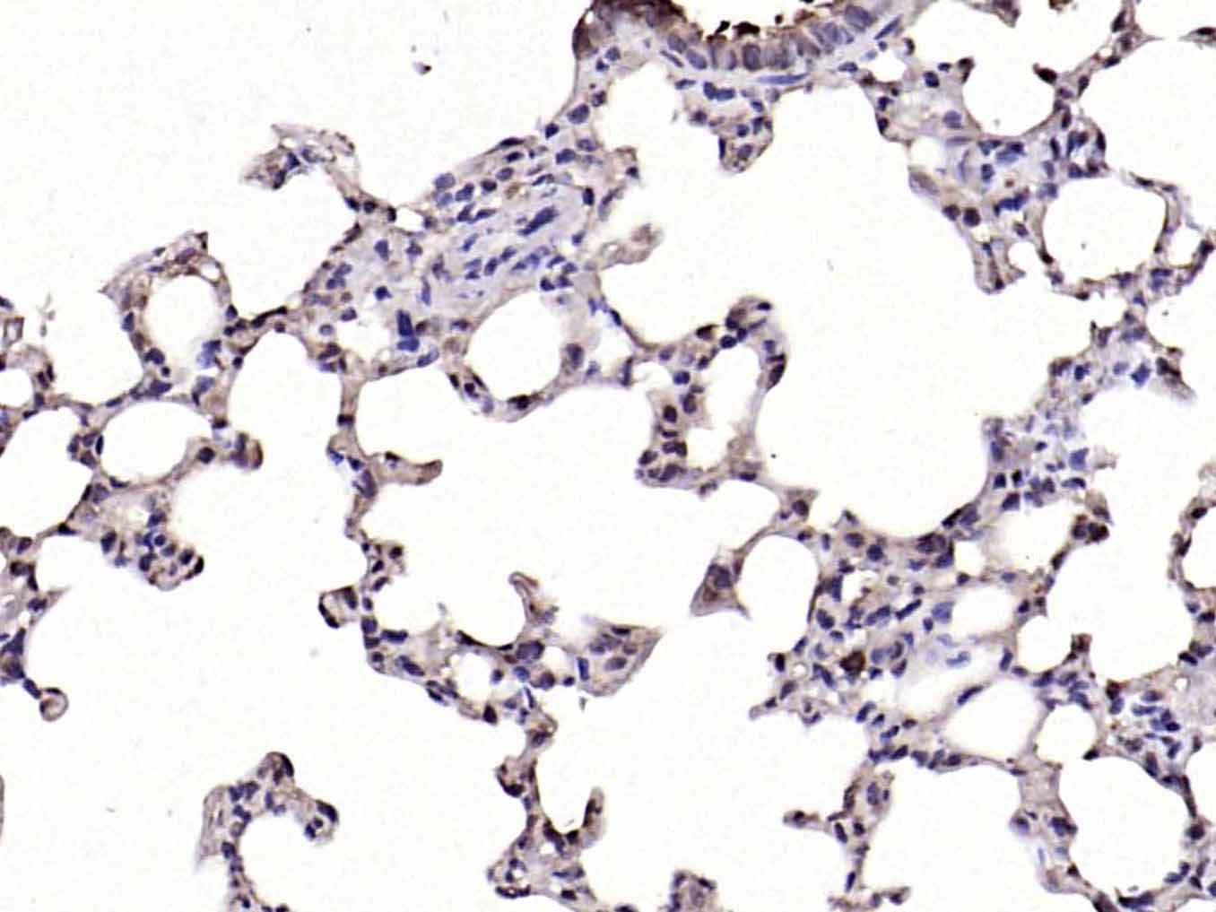 Rabbit anti-Phospho-IKBα(Ser32) Polyclonal Antibody