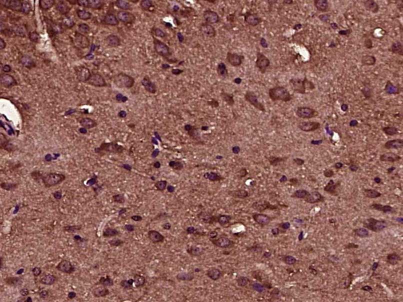 Rabbit anti-Phospho-IKBα(Ser32) Polyclonal Antibody