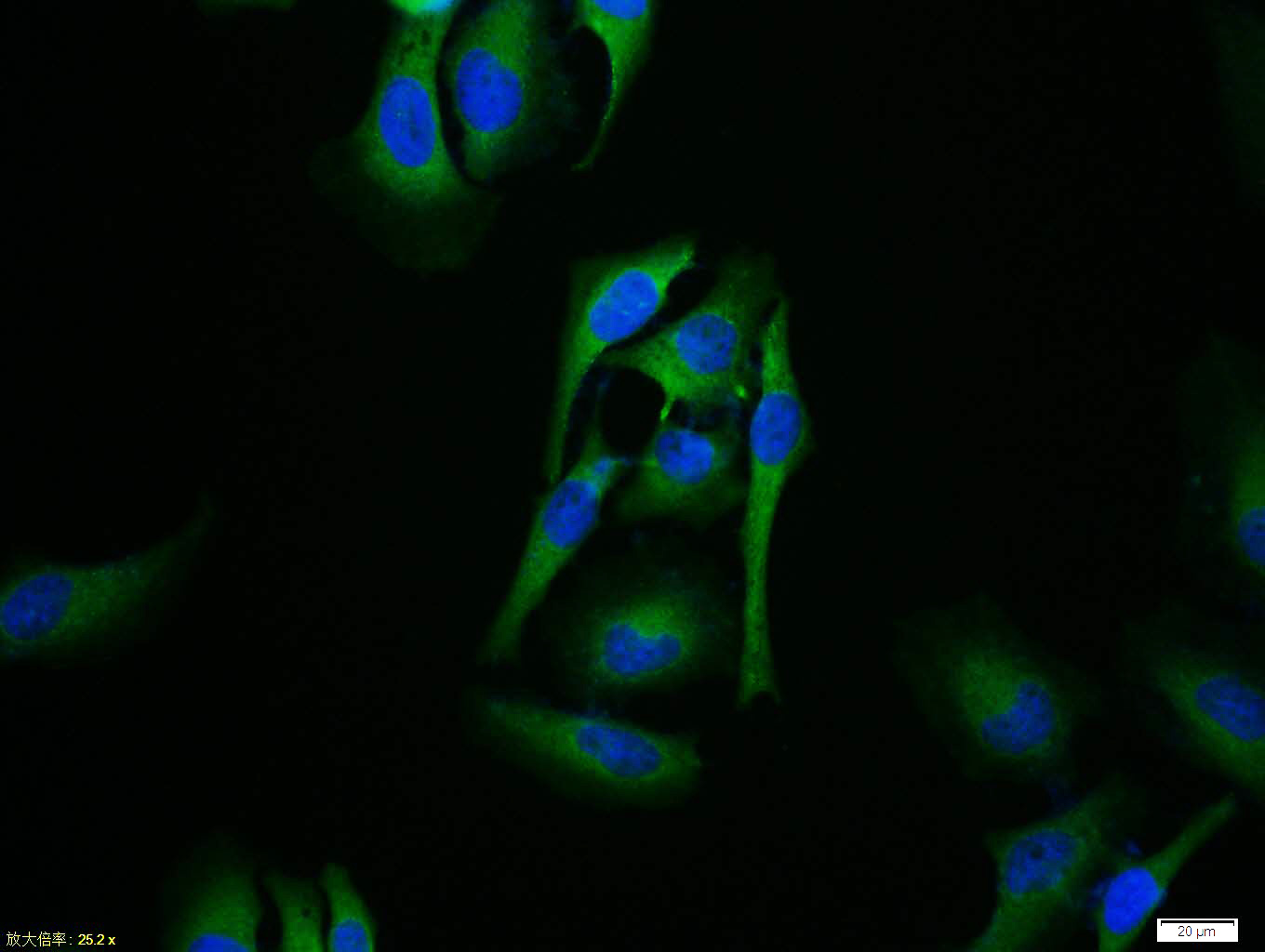 Rabbit anti-Phospho-IKBα(Ser32) Polyclonal Antibody