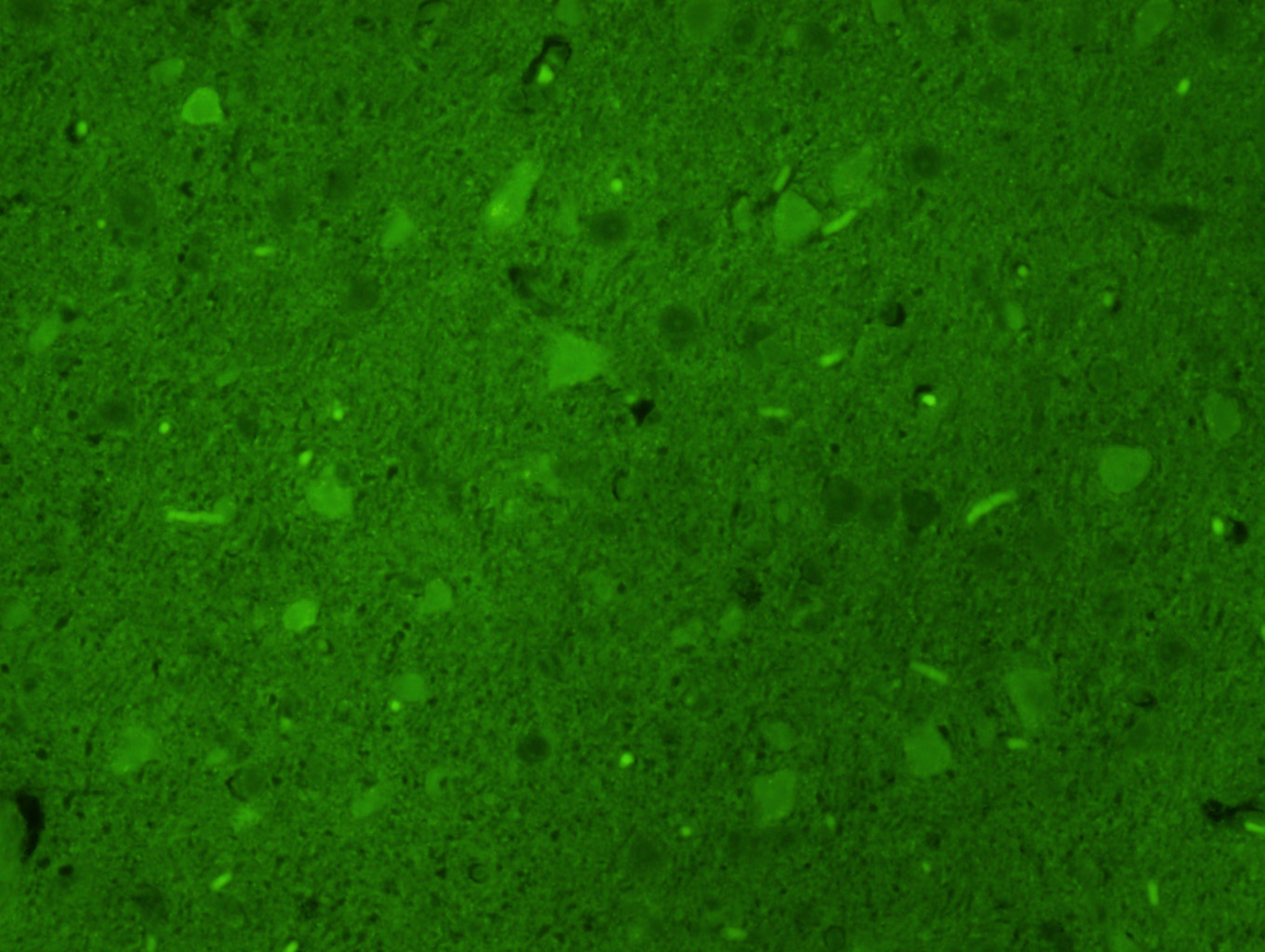 Rabbit anti-Tyrosine Hydroxylase Polyclonal Antibody