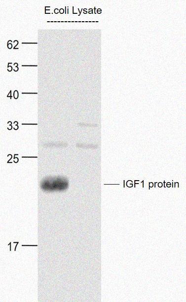 Rabbit anti-IGF 1 Polyclonal Antibody