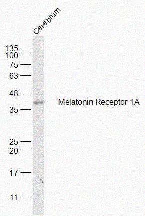 Rabbit anti-Melatonin Receptor 1A Polyclonal Antibody