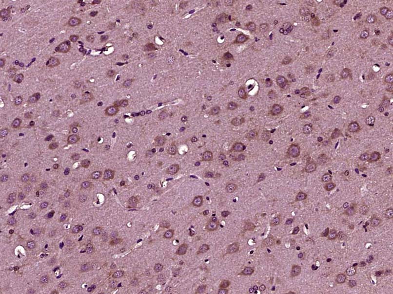 Rabbit anti-IGF 1 Polyclonal Antibody