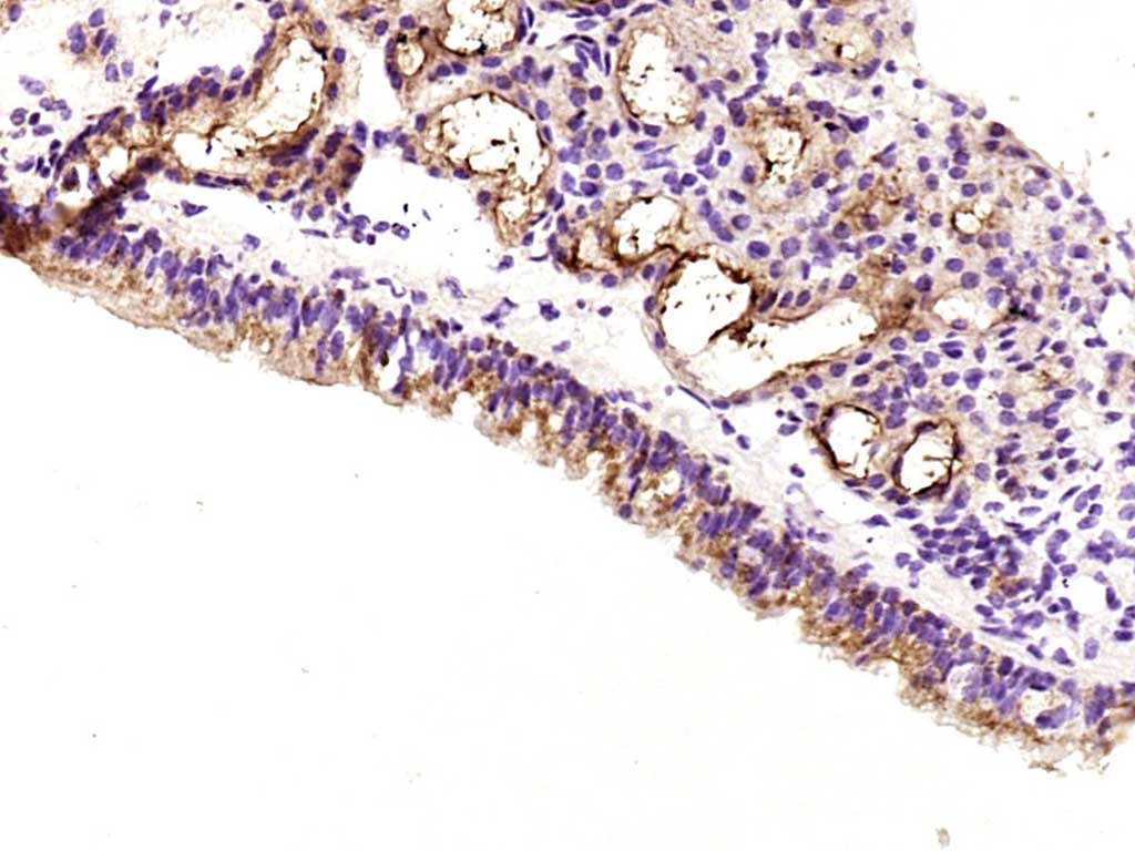 Rabbit anti-IGF 1 Polyclonal Antibody