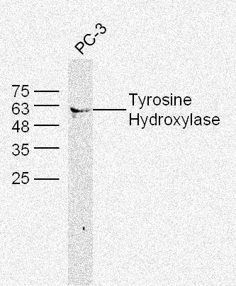Rabbit anti-Tyrosine Hydroxylase Polyclonal Antibody