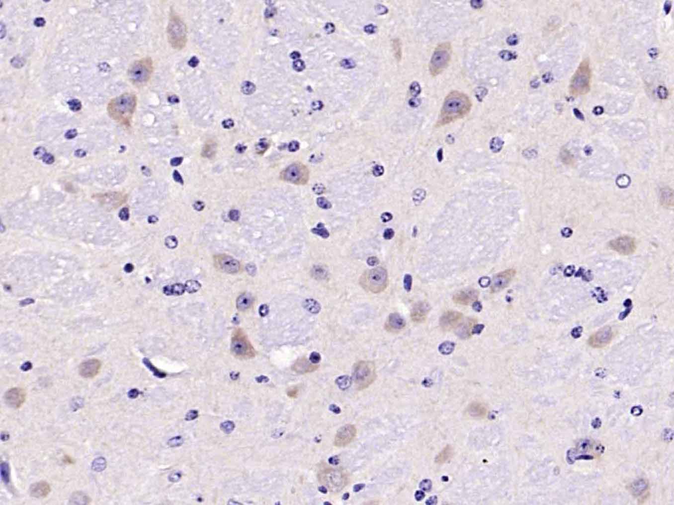 Rabbit anti-Tyrosine Hydroxylase Polyclonal Antibody