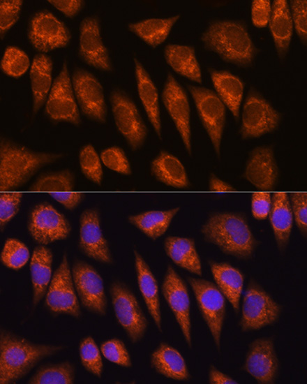 Rabbit anti-GOLGA4 Polyclonal Antibody