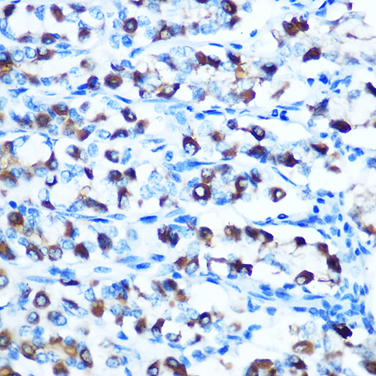 Rabbit anti-SLC11A2 Polyclonal Antibody