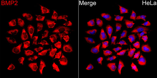 Rabbit anti-BMP2 Polyclonal Antibody