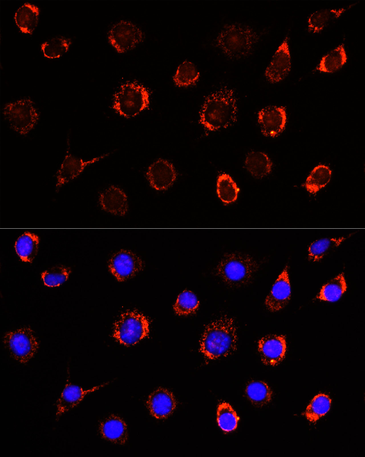 Rabbit anti-SLC25A1 Polyclonal Antibody