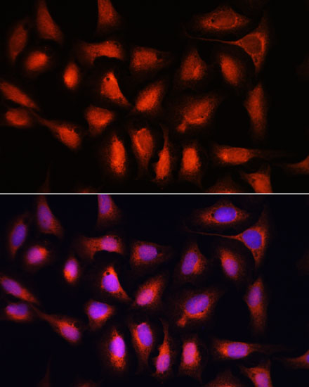 Rabbit anti-IRF1 Polyclonal Antibody