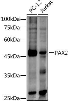 Rabbit anti-PAX2 Polyclonal Antibody