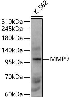 Rabbit anti-MMP9 Polyclonal Antibody