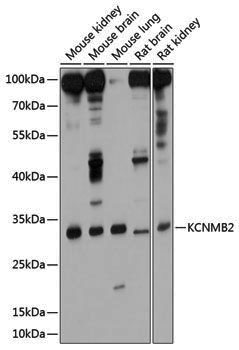 Rabbit anti-KCNMB2 Polyclonal Antibody