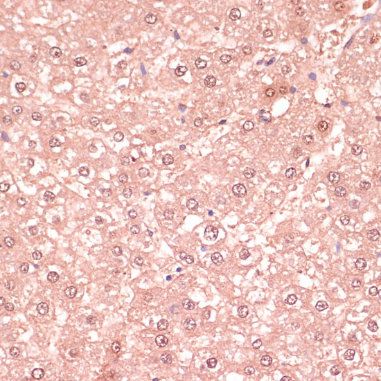 Rabbit anti-RNF5 Polyclonal Antibody