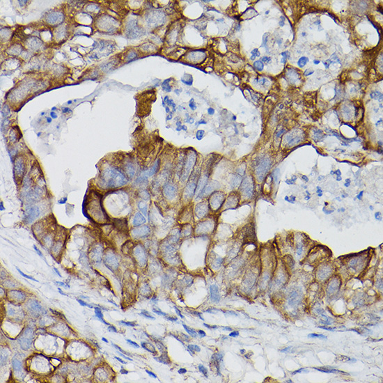 Rabbit anti-IL18R1 Polyclonal Antibody