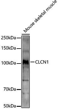 Rabbit anti-CLCN1 Polyclonal Antibody