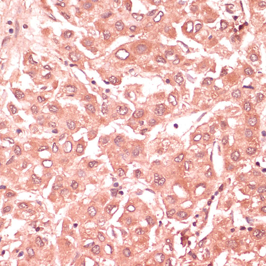 Rabbit anti-RNF5 Polyclonal Antibody