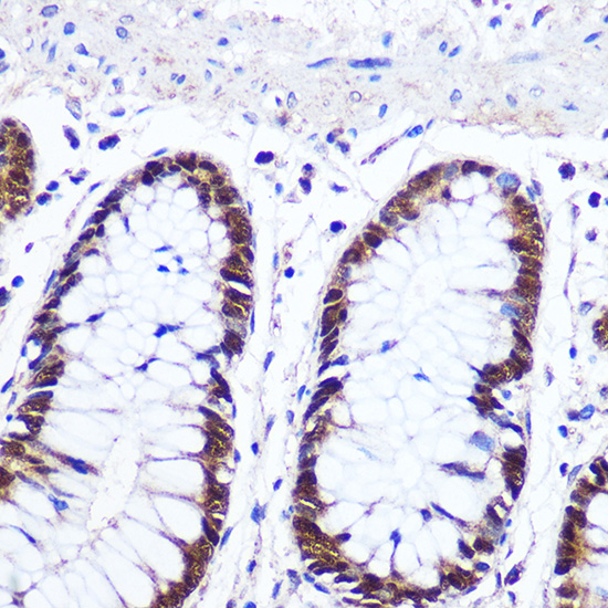 Rabbit anti-IRF1 Polyclonal Antibody