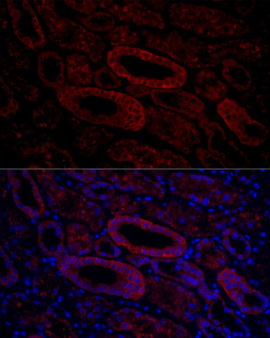 Rabbit anti-AQP3 Polyclonal Antibody