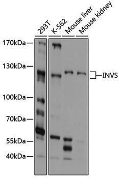 Rabbit anti-INVS Polyclonal Antibody