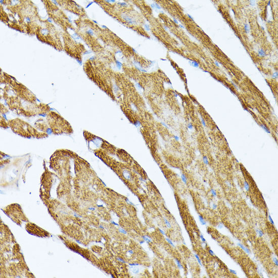 Rabbit anti-TPM2 Polyclonal Antibody
