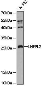 Rabbit anti-LHFPL2 Polyclonal Antibody