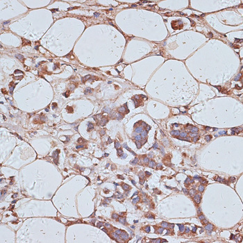 Rabbit anti-TAX1BP1 Polyclonal Antibody
