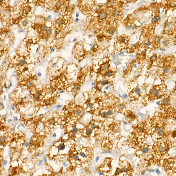 Rabbit anti-MT-CO1 Polyclonal Antibody