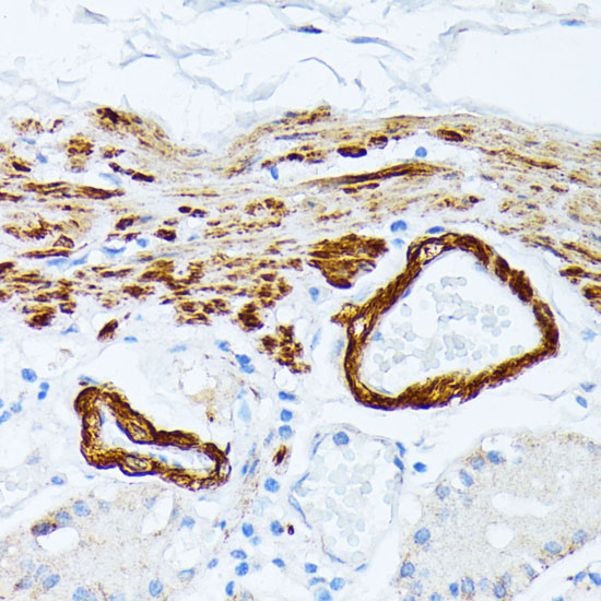 Rabbit anti-TPM2 Polyclonal Antibody