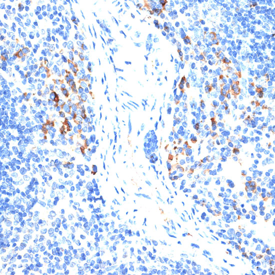Rabbit anti-MMP9 Polyclonal Antibody