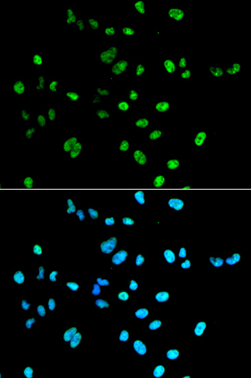 Rabbit anti-PAX2 Polyclonal Antibody
