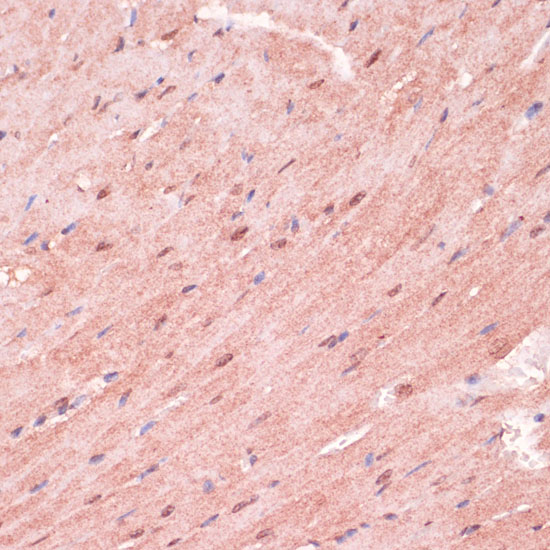 Rabbit anti-RNF5 Polyclonal Antibody