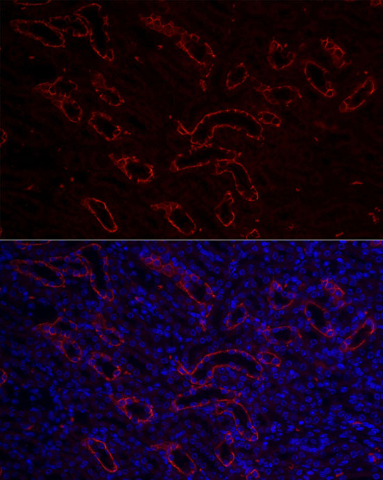 Rabbit anti-AQP3 Polyclonal Antibody