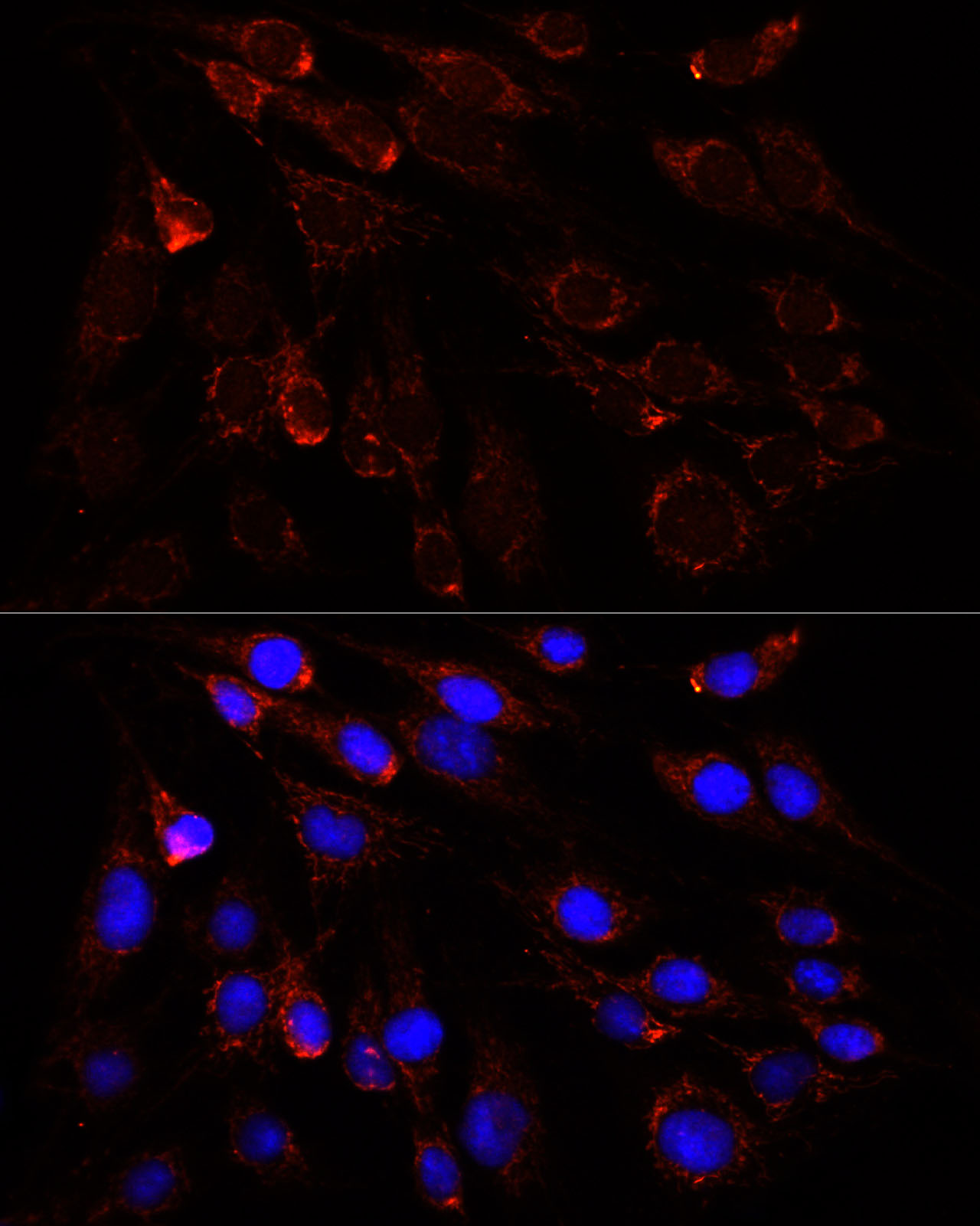 Rabbit anti-SLC25A1 Polyclonal Antibody