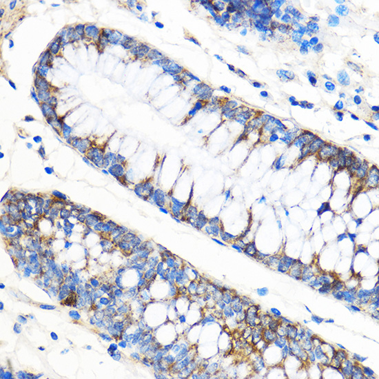 Rabbit anti-ATG5 Polyclonal Antibody