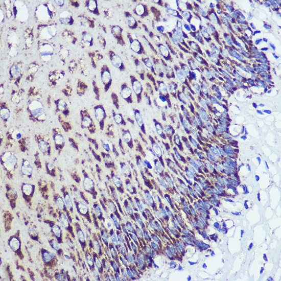 Rabbit anti-OSBPL8 Polyclonal Antibody