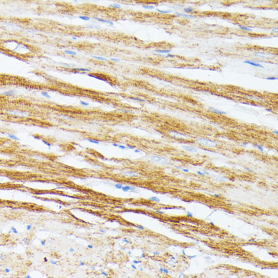 Rabbit anti-TPM2 Polyclonal Antibody