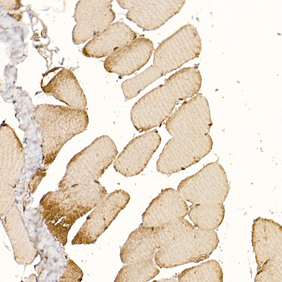 Rabbit anti-CLCN1 Polyclonal Antibody