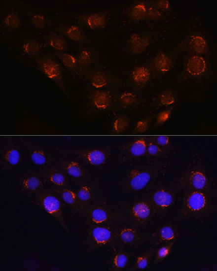 Rabbit anti-GOLGA4 Polyclonal Antibody