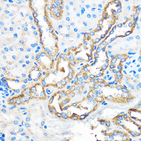 Rabbit anti-ATG5 Polyclonal Antibody