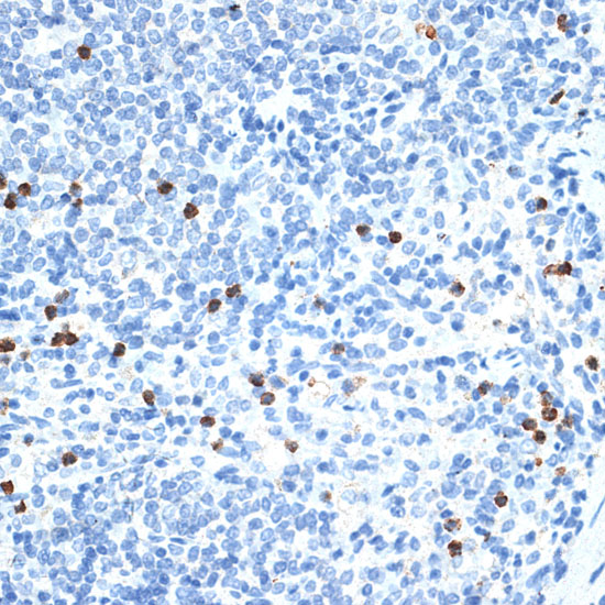 Rabbit anti-MMP9 Polyclonal Antibody
