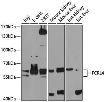Rabbit anti-FCRL4 Polyclonal Antibody