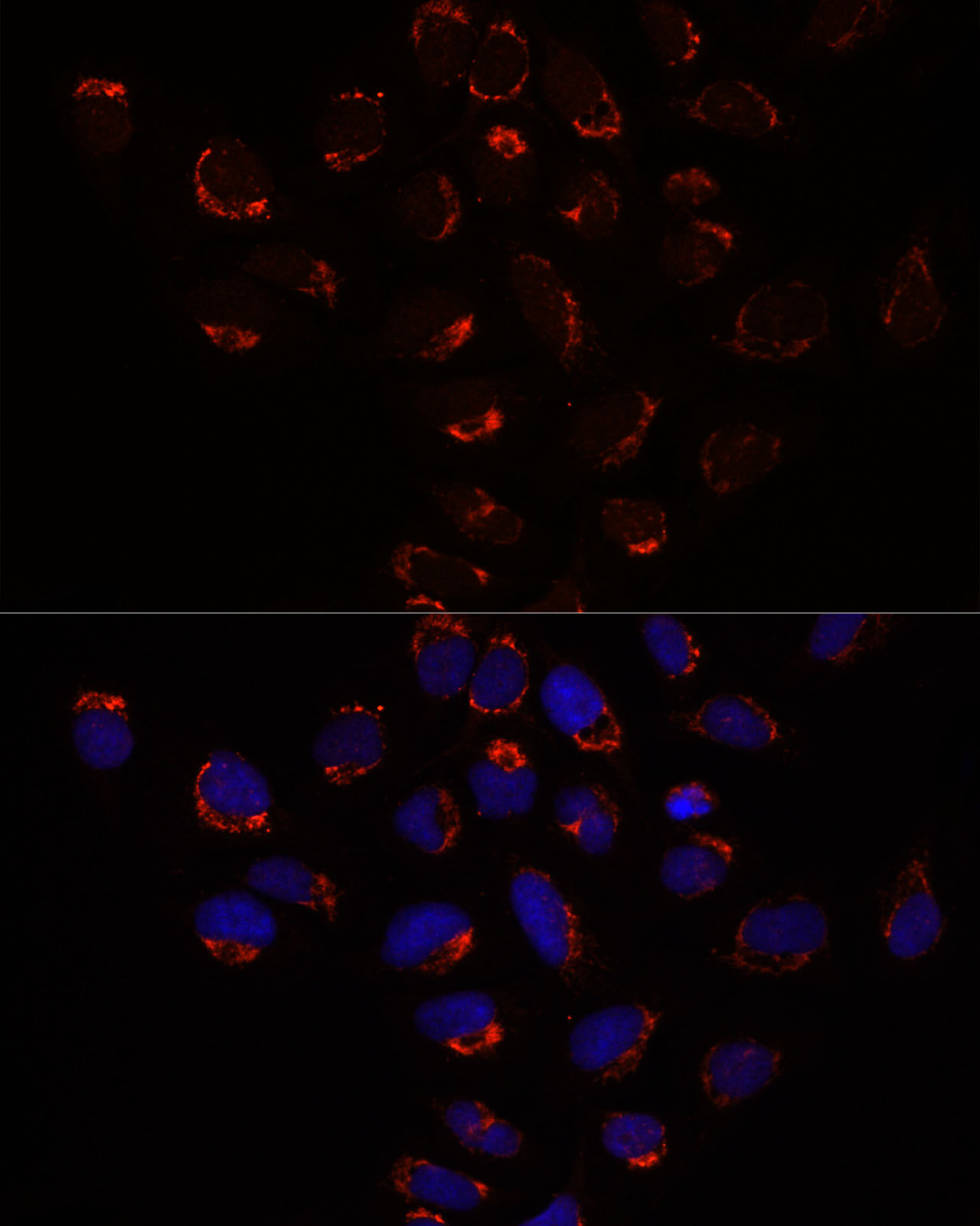 Rabbit anti-SLC25A1 Polyclonal Antibody