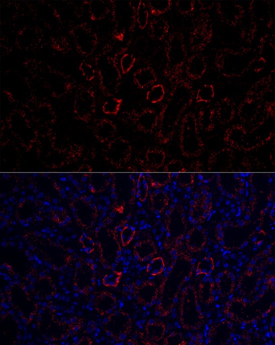 Rabbit anti-AQP3 Polyclonal Antibody