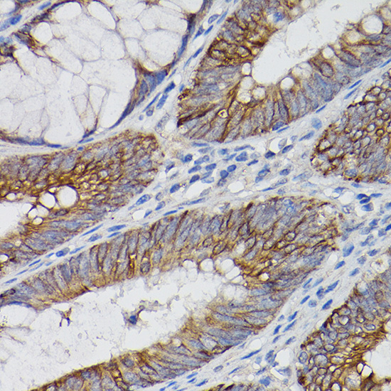 Rabbit anti-IL18R1 Polyclonal Antibody