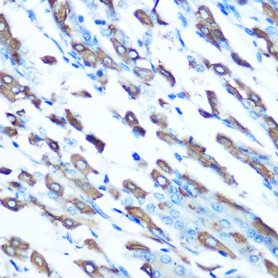 Rabbit anti-SLC11A2 Polyclonal Antibody