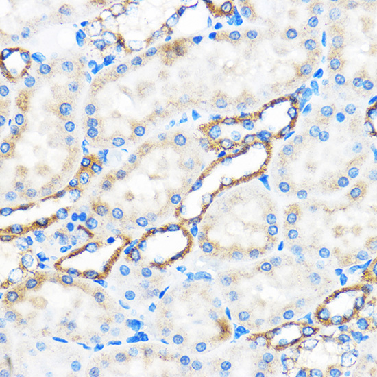 Rabbit anti-ATG5 Polyclonal Antibody
