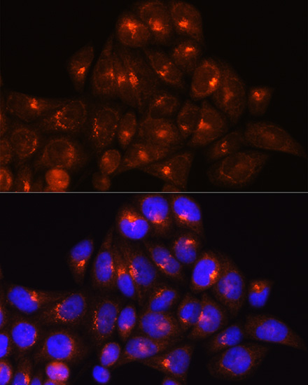 Rabbit anti-GOLGA4 Polyclonal Antibody