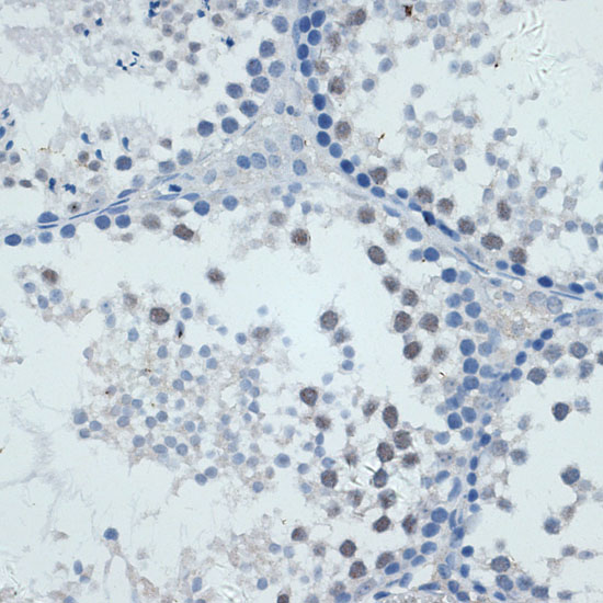 Rabbit anti-MMP9 Polyclonal Antibody